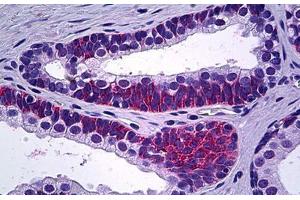 Human Prostate: Formalin-Fixed, Paraffin-Embedded (FFPE) (PPP3CC Antikörper  (N-Term))