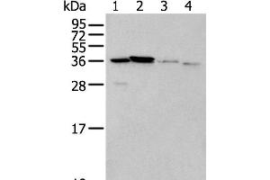 Western blot analysis of 293T cell Mouse brain tissue and Human kidney tissue lysates using LASP1 Polyclonal Antibody at dilution of 1:350 (LASP1 Antikörper)