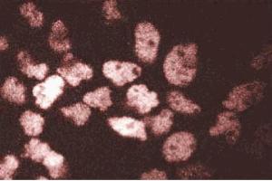 Immunofluorescent staining of A431 cells. (ARNT Antikörper  (AA 461-574))