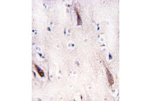 Formalin-fixed and paraffin-embedded human brain tissue reacted with ULK2 antibody (N-term) (ABIN392692 and ABIN2842178) , which was peroxidase-conjugated to the secondary antibody, followed by DAB staining. (ULK2 Antikörper  (N-Term))