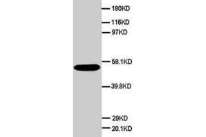 Western blot analysis of HeLa cell lysate. (SCG3 Antikörper  (C-Term))