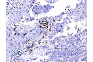 IHC analysis of SH3GL2 using anti-SH3GL2 antibody (ABIN7602229). (SH3G2 Antikörper  (AA 65-292))