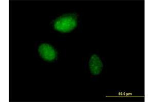 Immunofluorescence of purified MaxPab antibody to ZNF215 on HeLa cell. (ZNF215 Antikörper  (AA 1-304))