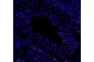 Immunofluorescence of paraffin embedded rat lung using colEC12 (ABIN7073552) at dilution of 1:650 (250x lens)