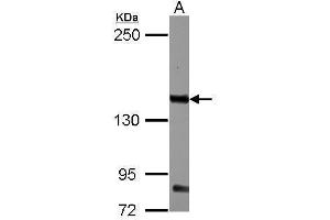 WB Image Sample (30 ug of whole cell lysate) A: K562 5% SDS PAGE antibody diluted at 1:1000 (CD131 Antikörper  (Center))