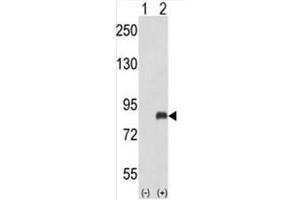 Western blot analysis of ADRBK2 (arrow) using rabbit polyclonal ADRBK2 Antibody (ADRBK2 Antikörper  (N-Term))