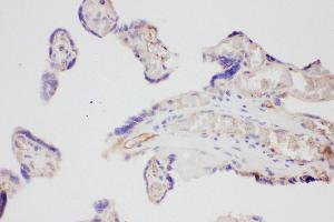 Anti-VEGF Picoband antibody,  IHC(P): Human Placenta Tissue