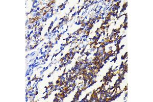 Immunohistochemistry of paraffin-embedded human appendix using NF-κB2 antibody (ABIN7268983) at dilution of 1:100 (40x lens). (NFKB2 Antikörper)