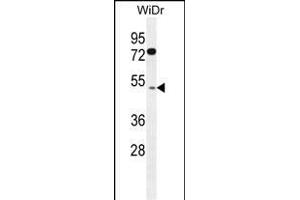 RMD1 Antibody (N-term) (ABIN655830 and ABIN2845248) western blot analysis in WiDr cell line lysates (35 μg/lane). (RMD1 Antikörper  (N-Term))