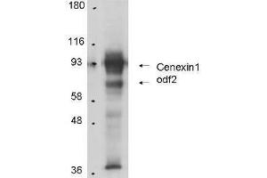 Anti-Cenexin-1 in Western Blot using  Immunochemical's Protein A Purified Anti-Cenexin-1 antibody shows detection of Cenexin-1 in total cell lysates from mouse F9 embryonic carcinoma cells. (ODF2 Antikörper)