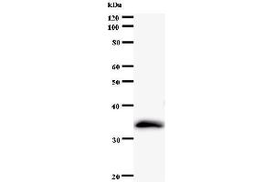 Western Blotting (WB) image for anti-Polymerase (RNA) I Polypeptide D, 16kDa (POLR1D) antibody (ABIN931069)