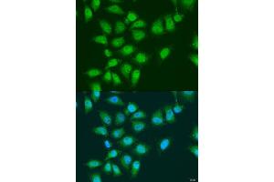 Immunofluorescence analysis of U2OS cells using EYA3 antibody (ABIN6292902) at dilution of 1:100. (EYA3 Antikörper)