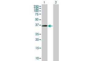 Western Blotting (WB) image for FAHD2A 293T Cell Transient Overexpression Lysate(Denatured) (ABIN1336244)