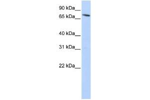 WB Suggested Anti-SLC11A2 Antibody Titration:  0. (SLC11A2 Antikörper  (N-Term))