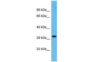 Western Blotting (WB) image for anti-Olfactory Receptor, Family 1, Subfamily L, Member 4 (OR1L4) (C-Term) antibody (ABIN2791715) (OR1L4 Antikörper  (C-Term))