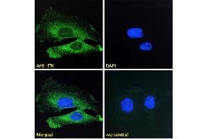 Immunofluorescence (IF) image for anti-IL2-Inducible T-Cell Kinase (ITK) (C-Term) antibody (ABIN184605)