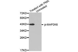 Western blot analysis of extracts from HL60 cells, using phospho-MAP2K6-S207 antibody (ABIN2988139). (MAP2K6 Antikörper  (pSer207))