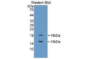 Western blot analysis of the recombinant protein. (GDF3 Antikörper  (AA 253-366))