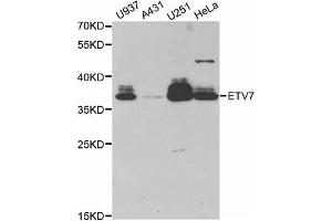 Western Blotting (WB) image for anti-Ets Variant 7 (ETV7) antibody (ABIN1882381) (ETV7 Antikörper)