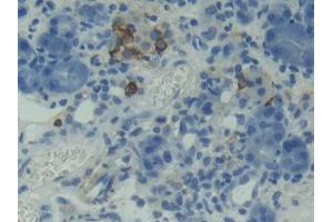 Immunohistochemistry (IHC) image for anti-Tumor Necrosis Factor Receptor Superfamily, Member 13C (TNFRSF13C) (AA 45-169) antibody (ABIN1172697)