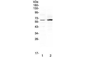 Western blot testing of human 1) placenta and 2) MCF7 lysate with FZD4 antibody at 0. (FZD4 Antikörper)