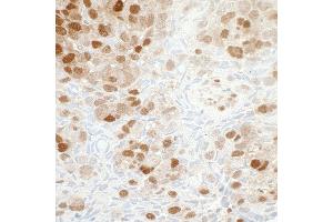 Immunohistochemistry (IHC) image for anti-Nicotinamide phosphoribosyltransferase (NAMPT) (AA 400-450) antibody (ABIN7454014)