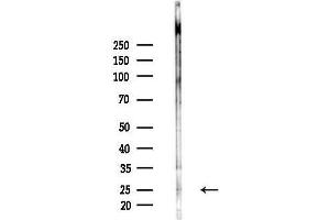 Western blot analysis of lysates from MCF7 cells(heat-shock,45 min treatment), using Flt3 ligand Antibody at 1/1000 dilution.