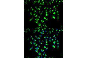 Immunofluorescence analysis of MCF-7 cell using CD86 antibody. (CD86 Antikörper)