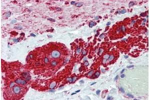 Human Small Intestine, Myenteric Plexus: Formalin-Fixed, Paraffin-Embedded (FFPE) (TUBB2A Antikörper  (AA 1-446))
