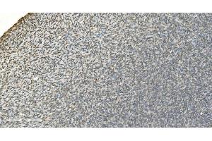 IHC analysis of LSM7 using anti-LSM7 antibody (ABIN7598937).