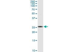 RNF170 monoclonal antibody (M01), clone 2D6. (RNF170 Antikörper  (AA 121-193))