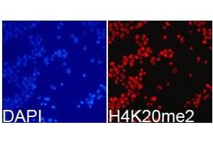 Immunofluorescence analysis of 293T cell using H4K20me2 antibody. (Histone 3 Antikörper  (2meLys20))