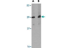Western blot analysis of Apba1 in mouse spleen tissue lysate with Apba1 polyclonal antibody  at (A) 1 and (B) 2 ug/mL .