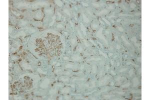 Immunohistochemistry (IHC) image for anti-Complement Component C4d (C4d) (Internal Region) antibody (ABIN870587) (Complement C4d Antikörper  (Internal Region))