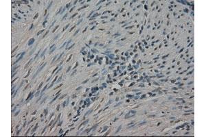 Immunohistochemical staining of paraffin-embedded Ovary tissue using anti-NEK6mouse monoclonal antibody. (NEK6 Antikörper)
