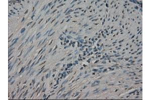 Immunohistochemical staining of paraffin-embedded Ovary tissue using anti-NEK6mouse monoclonal antibody.