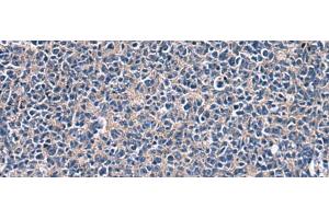 Immunohistochemistry of paraffin-embedded Human tonsil tissue using LAMP3 Polyclonal Antibody at dilution of 1:30(x200) (LAMP3 Antikörper)