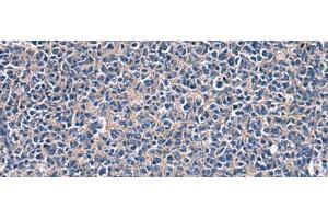 Immunohistochemistry of paraffin-embedded Human tonsil tissue using LAMP3 Polyclonal Antibody at dilution of 1:30(x200) (LAMP3 Antikörper)