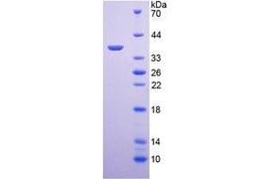 Image no. 1 for Arginase (ARG) (AA 1-323) (Active) protein (His tag) (ABIN6239896)