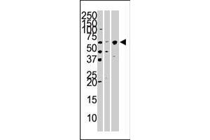 The KPNA4 polyclonal antibody  is used in Western blot to detect KPNA4 in Hela (left) , mouse brain (middle) , and HepG2 (right) cell and tissue lysates. (KPNA4 Antikörper  (N-Term))