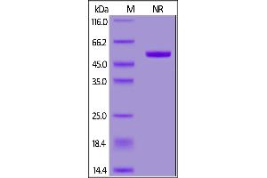 SDS-PAGE (SDS) image for Tumor Necrosis Factor (Ligand) Superfamily, Member 13 (TNFSF13) (AA 111-250) (Active) protein (His tag,DYKDDDDK Tag) (ABIN7013494)