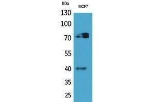 Western Blotting (WB) image for anti-Myeloproliferative Leukemia Virus Oncogene (MPL) (Internal Region) antibody (ABIN3187963) (MPL Antikörper  (Internal Region))