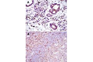 Immunohistochemical analysis of paraffin-embedded human prostate tissues (A) and tonsil tissues (B) using BID monoclonal antibody, clone 3C5  with DAB staining. (BID Antikörper)