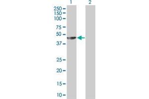 Western Blot analysis of MAGEA4 expression in transfected 293T cell line by MAGEA4 MaxPab polyclonal antibody. (MAGEA4 Antikörper  (AA 1-317))