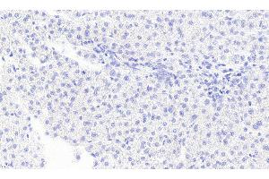 ABIN5872058 Negative Control showing staining of paraffin embedded Human Liver, with no primary antibody. (MGLL Antikörper)