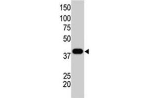 The SUMO1 polyclonal antibody  is used in Western blot to detect GST-SUMO1 fusion protein. (SUMO1 Antikörper  (C-Term))