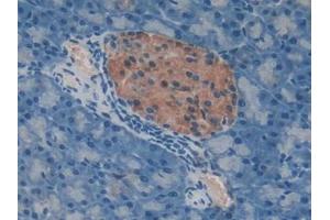 Immunohistochemistry (IHC) image for anti-TIMP Metallopeptidase Inhibitor 3 (TIMP3) (AA 20-211) antibody (ABIN1172379)