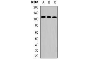 Western blot analysis of DPD expression in Hela (A), HepG2 (B), Jurkat (C) whole cell lysates. (DPYD Antikörper)