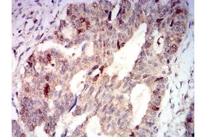 Immunohistochemistry (IHC) image for anti-Aurora Kinase A (AURKA) (AA 268-404) antibody (ABIN5611121)