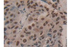 Immunohistochemistry (IHC) image for anti-Hepatoma-Derived Growth Factor (HDGF) (AA 10-240) antibody (ABIN7432232)